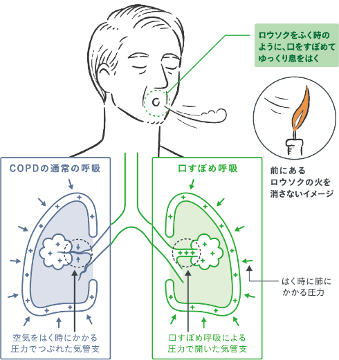 呼吸 ウィーズ 総論 図13